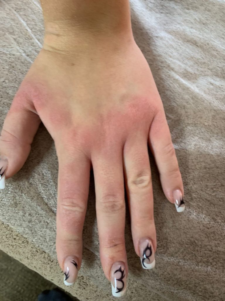 активатор клеток отзывы
экзема