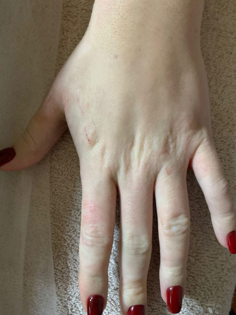 активатор клеток отзывы
экзема