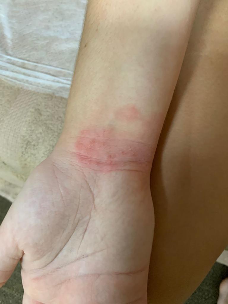 активатор клеток отзывы
экзема