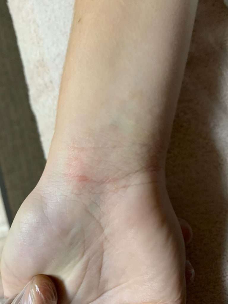 активатор клеток отзывы
экзема