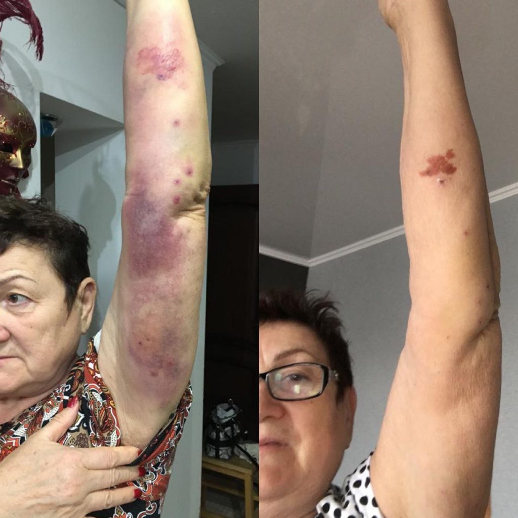 активатор клеток