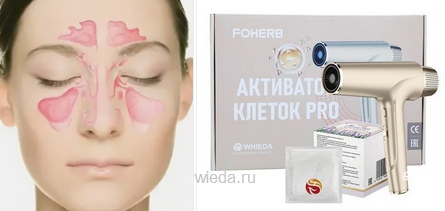 Лечение гайморита активатором клеток